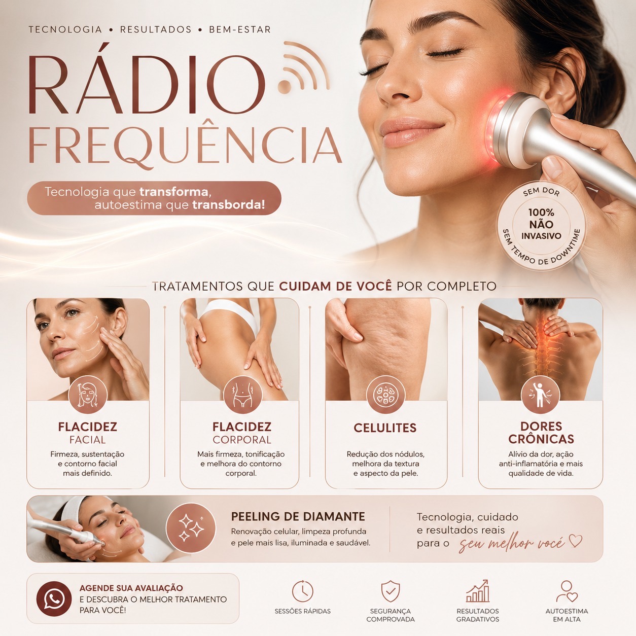 A radiofrequência é um tratamento estético muito utilizado para melhorar a qualidade da pele, estimular colágeno e auxiliar também em dores e tensões musculais. O calor gerado pelo aparelho promove uma resposta natural do organismo, trazendo vários benefícios. ## Benefícios da radiofrequência no tratamento estético ✨ Estimula a produção de colágeno Ajuda na firmeza da pele, melhorando a flacidez facial e corporal. ✨ Melhora a aparência das rugas e linhas finas Deixa a pele com aspecto mais jovem, firme e uniforme. ✨ Auxilia no tratamento da celulite Melhora a circulação e a oxigenação dos tecidos, reduzindo o aspecto da celulite. ✨ Redução da flacidez corporal Muito utilizada em abdômen, braços, glúteos e coxas. ✨ Melhora da circulação sanguínea Favorece a nutrição dos tecidos e ajuda na recuperação da pele. ✨ Auxilia na gordura localizada Pode ajudar na melhora do contorno corporal quando associada a hábitos saudáveis. ✨ Melhora da textura e elasticidade da pele A pele fica mais hidratada, firme e revitalizada. ✨ Procedimento não invasivo Sem cortes e sem necessidade de afastamento das atividades diárias. ✨ Sensação relaxante e confortável O calor da radiofrequência promove relaxamento muscular e bem-estar. ✨ Pode auxiliar em dores crônicas Na fisioterapia integrativa, a radiofrequência também pode ser utilizada para relaxamento muscular, melhora da circulação e auxílio em dores musculares e tensões. ## Áreas mais tratadas * Face * Papada * Abdômen * Braços * Glúteos * Coxas * Região lombar ## Sugestão de frase para Instagram “Mais firmeza, autoestima e cuidado com você! ✨ A radiofrequência estimula colágeno, melhora a flacidez, auxilia na celulite e ainda promove relaxamento e bem-estar.” Se quiser, também posso criar: * texto curto para post; * legenda para Instagram; * carrossel com benefícios; * arte para divulgação; * versão incluindo fisioterapia integrativa e dores crônicas.